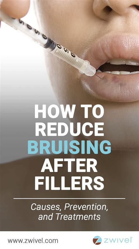 Easy Skin Care Tips You Should Follow Facial Fillers Reduce Bruising