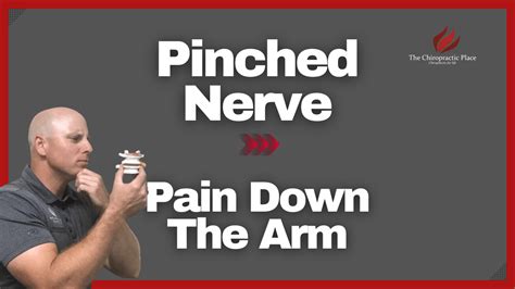 Pinched Nerve Pain Down The Arm The Chiropractic Place