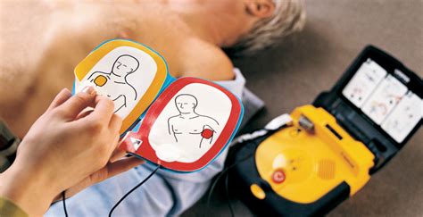 Must You Train Staff To Use Automated External Defibrillators Aeds
