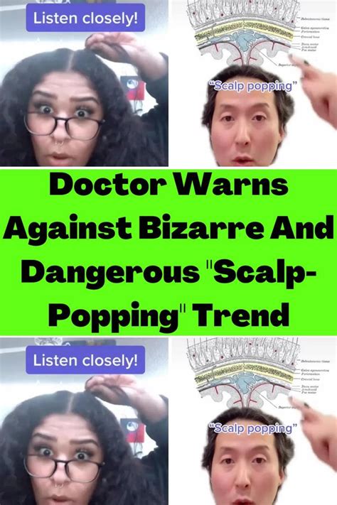 Doctor Warns Against Bizarre And Dangerous Scalp Popping Trend