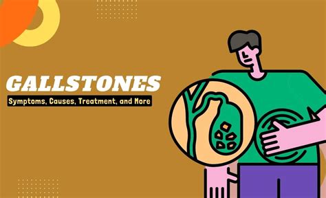 Gallstones Symptoms Causes Treatment And More Resurchify