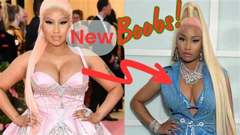 Nicki Minajs Bold Revelation Shows Off Results Of Breast Reduction