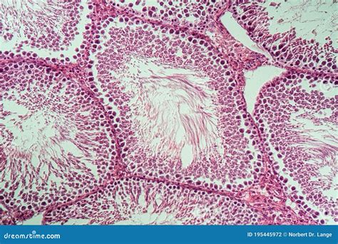 Testis Cross Section With Sperm