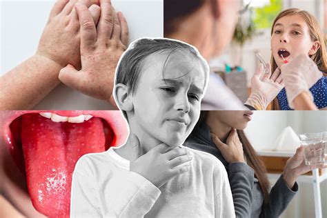 Strep A Scarlet Fever Cases Hit Record High