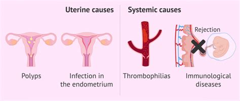 Uterine And Systemic Causes Of Implantation Failure