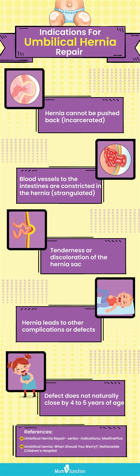 Causes Of Umbilical Hernia In Babies Symptoms And Treatment