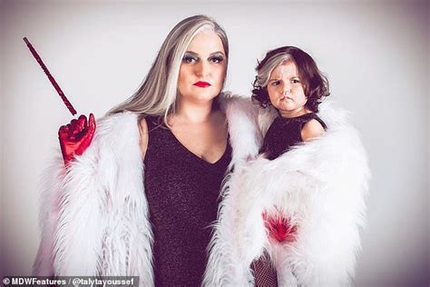 Two Year Old Girl Born With Striking White Streak In Her Hair Due To