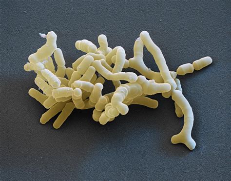 Bifidobacteria Sem 1 Photograph By Eye Of Science Pixels