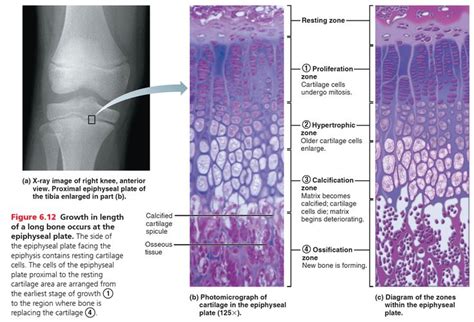 X Ray Image Of A Right Knee Showing The Epiphyseal Plates Of The