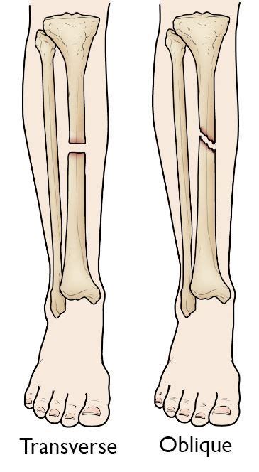Haus And Garten Tibia Bone Cookie Cutterskeleton Anatomy Shinbone Doctor