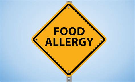 Food Allergens Resource Guide 2017 08 17 Snack And Bakery Snack