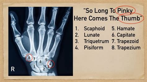 Carpal Bone Mnemonic And Names Wrist Anatomy Made Easy — Ezmed