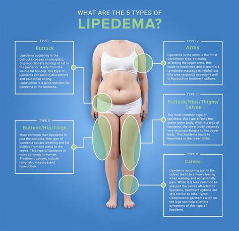 Lipedema A Medical Or Aesthetical Condition And How To Treat It Amwaj Polyclinic I Dubai