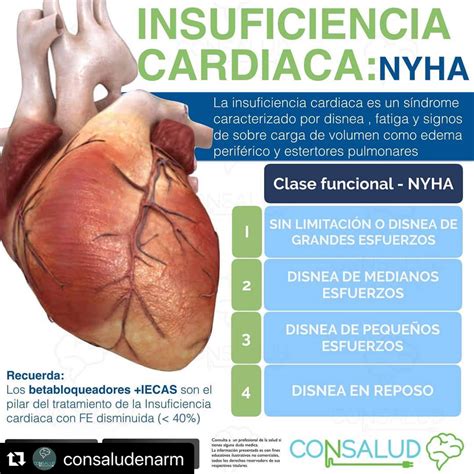 Pin De Liza Robles En Salud Insuficiencia Cardiaca Betabloqueadores