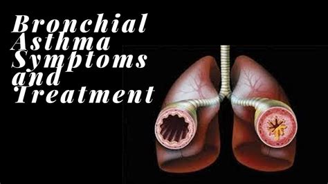 Bronchial Asthma Symptoms And Treatment Youtube