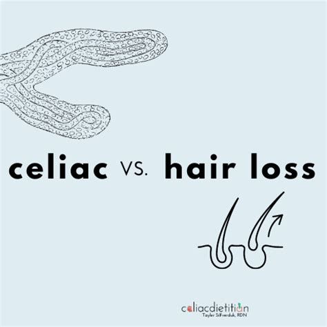 Celiac Disease And Hair Loss Tayler Silfverduk