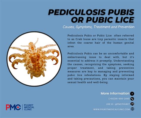 Pediculosis Pubis Or Pubic Lice Causes Symptoms Treatment And