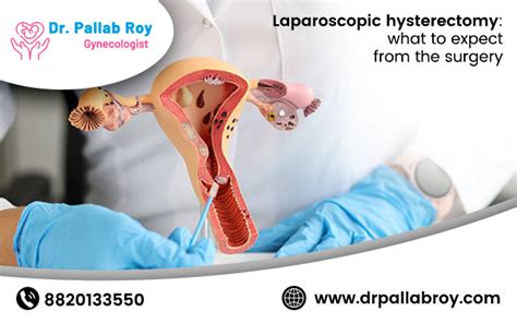 What To Expect After A Laparoscopic Hysterectomy Surgery