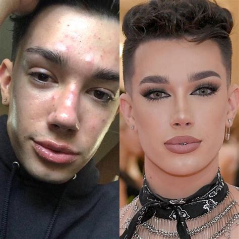 Wow James Charles Without Facetune Flawless Skin James Charles