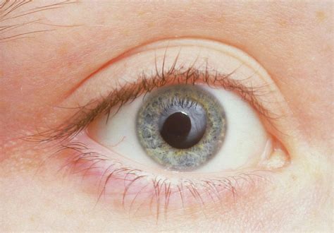Human Eye Showing Dilated Pupil Photograph By Martin Dohrn Science Photo Library Pixels