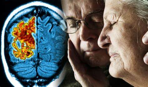 Dementia New Research Suggests If Men Or Women Are More Likely To Develop Symptoms Uk