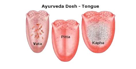 Ayurvedic Pulse And Tongue Diagnosis In Kialla