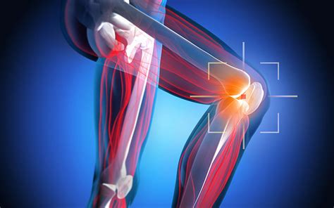 Mpfl Medial Patellofemoral Ligament Treatment And Tips