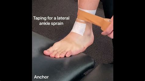 Inversion Ankle Sprain Taping
