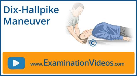 Dix Hallpike Maneuver Youtube