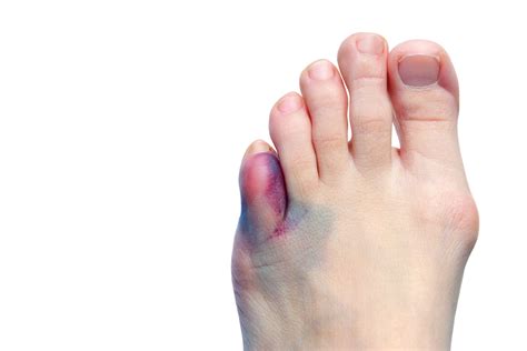 Five Myths About Foot Care Shoal Creek Foot And Ankle Center