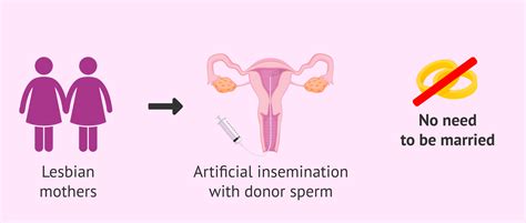 donor intrauterine insemination what is it and how much is 43 off
