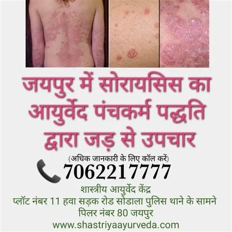 Psoriasis Ayurvedic Treatment Jaipur In Jaipur Shastriya Ayurveda Id