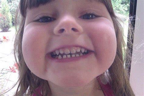 Dark Tooth Why Your Child Has A Discolored Tooth Oral Answers