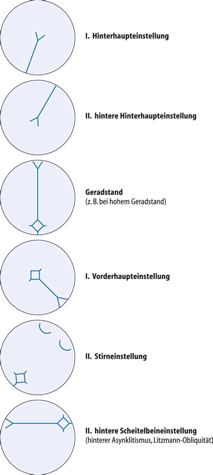 1 programm beispiel montag anreise, story of berlin, karaoke dienstag stadtrundfahrt, museumsinsel berlin mittwoch gedenkstätte hohenschönhausen. Pathologische Geburt | SpringerLink