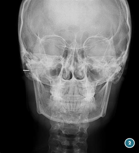 Telerradiografía de Cráneo Lateral o Frontal Radiología Dental Las Palmas
