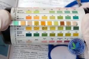 The ph of urine can be determined during a urine test and this particular urine test can also be performed at home. Acidity & Cannabis: pH Demystified. UPG Cannabis Product ...