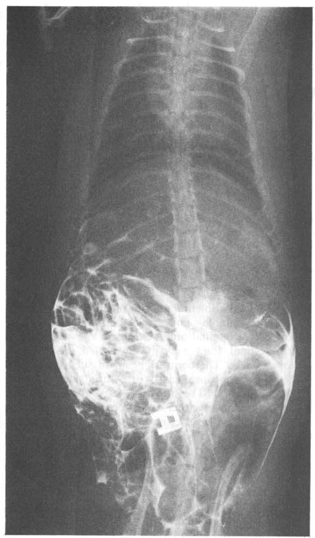 Pure Barium Sulphate Immediately After Introduction Into The Peritoneum