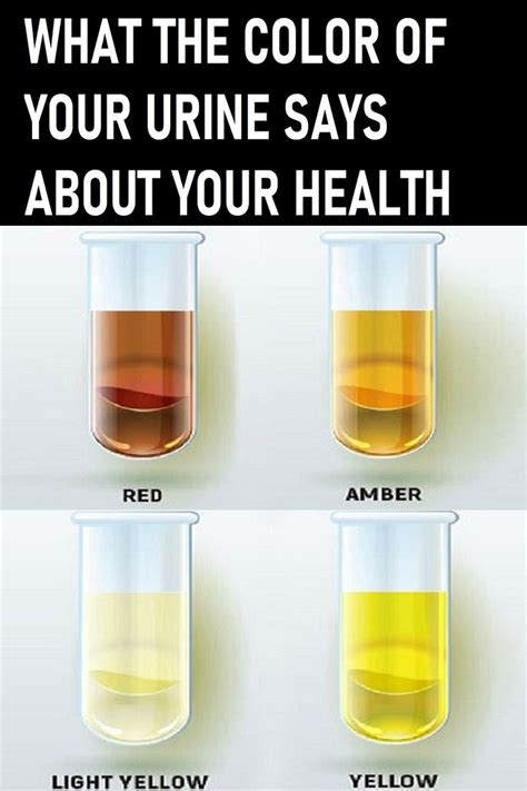 Image Result For Urine Color Chart Medical Office Assistant Nursing