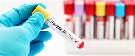 Hepatit B Nedir Belirti Ve Tedavi Y Ntemleri Nelerdir Sa L Kl Ya Am