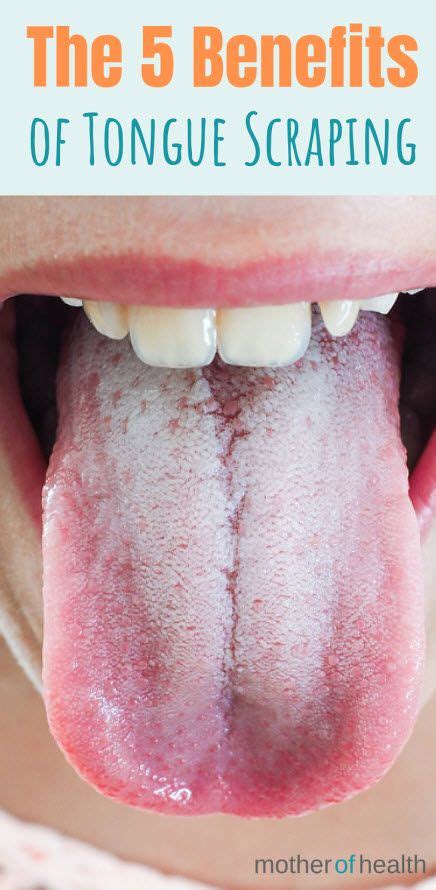 The 5 Benefits Of Tongue Scraping In 2020 Oral Health Health Gum