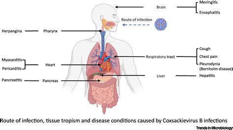 Coxsackie B Virus Trends In Microbiology