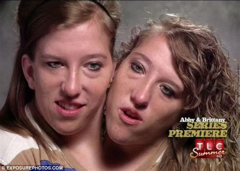 TLC Made A Documentary Brittany Documentaries Conjoined Twins