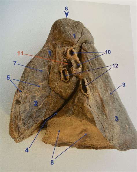 P 213 Right Lung Mediastinal Surface Diagram Quizlet