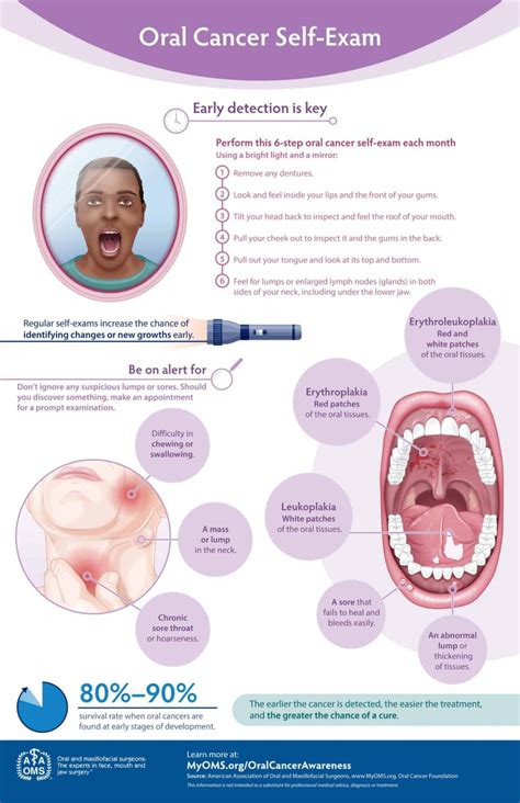 Oralcancerselfexam Oral And Maxillofacial Surgical Specialists Pc