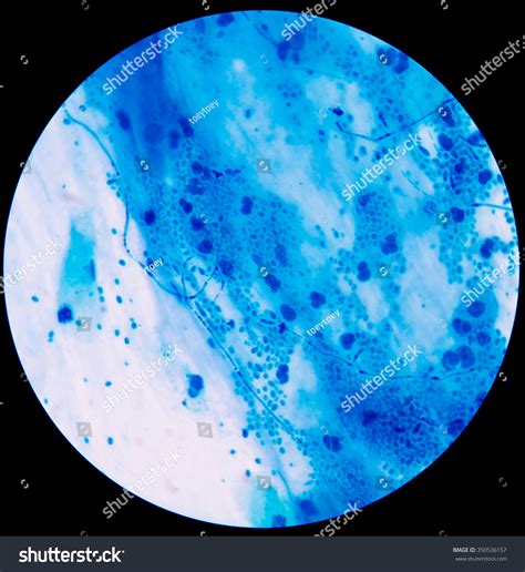 Branching Budding Yeast Cells Pseudohyphae Sputum Stock Photo 350536157