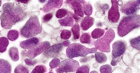 Mycoplasma Genitalium Síntomas Causas Y Tratamiento De Esta Ets