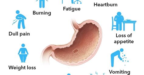 What Are The Symptoms Of Stomach Ulcer Infographic