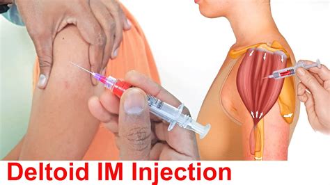 How To Give An Intramuscular Im Injection In Deltoid Muscle In Shoulder Easily At Home Youtube