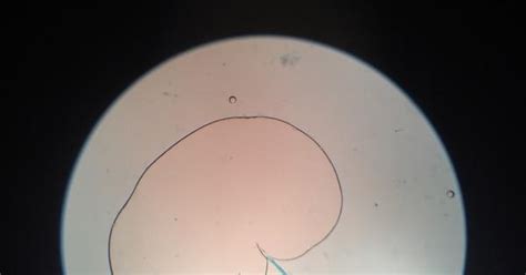 This Microorganism Under A Microscope Looks Like Surprise Butt Sex Imgur