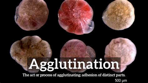 How Does Agglutination Look How To Say Agglutination In English What Is Agglutination